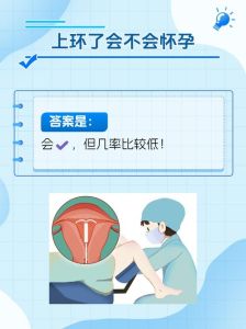 女生上环后还能挽回吗，取环后备孕攻略，健康生活迎好孕！